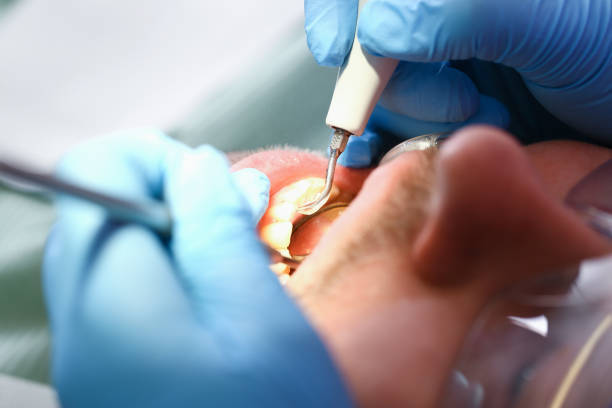 Professional Emergency Dental Service in ND